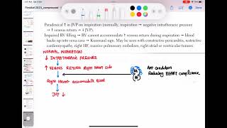 Kussmauls sign cardiology 116 First Aid USMLE Step 1 in UrduHindi [upl. by Florenza]