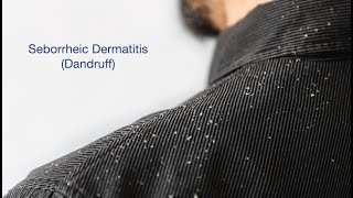 Seborrheic Dermatitis and Hair Loss [upl. by Edwina]