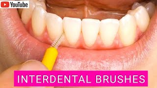 How to Use Interdental Brushes Correctly Top Tips [upl. by Audris]