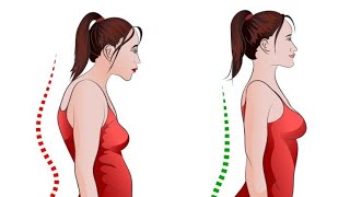 UPPER CROSS SYNDROME physiocell [upl. by Atikam]