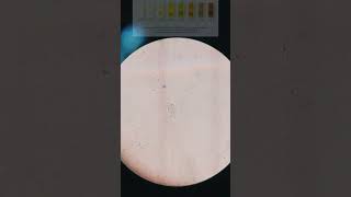 🎥Trichomoniasis Trichomonas in urine under 🎥📲Microscope Its Symptoms and sign With treatment [upl. by Mathilda997]