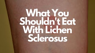 Foods to Avoid With Lichen Sclerosus amp Possible Treatments [upl. by Kippie]