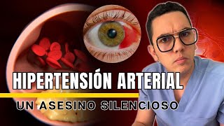 Hipertensión arterial un asesino silencioso al acecho  Dr William Guerrero [upl. by Simaj]