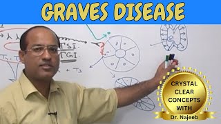 Graves Disease  Pathophysiology🩺 [upl. by Quick]