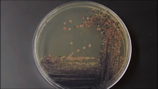 Colors  Bacterial Pigments TimeLapse [upl. by Noah818]