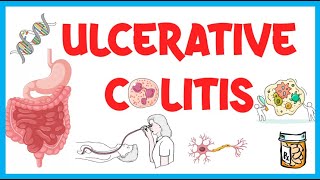 Ulcerative Colitis Causes Risk Factors Pathogenesis Clinical Presentation Diagnosis amp Treatment [upl. by Ahsenyl]