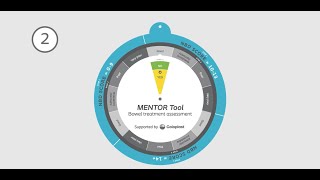 MENTOR Tool [upl. by Dylane]