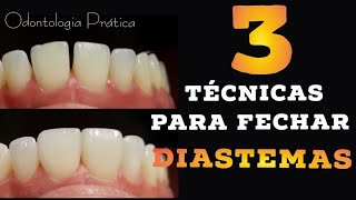 🛑DIASTEMAS 3 TÉCNICAS PARA FECHAMENTOS DE ESPAÇOS ✍👌 [upl. by Yttiy]