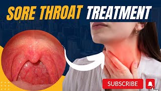 How to get rid of Sore throat  Sore throat remedies sore throat treatment  sore throat MHCP [upl. by Sebastiano]