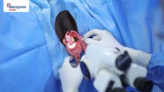 Basics of Colposcopy Procedure [upl. by Mikkel311]