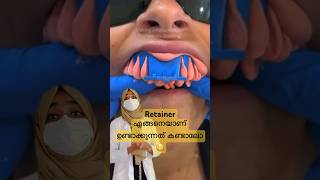 RETAINER ഉണ്ടാക്കുന്നത്😱കാണിച്ചു തരാംdentist malayalam youtubeshorts braces [upl. by Mungam]