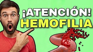 ¿QUE ES LA HEMOFILIA💢 FISIOPATOLOGÍA SINTOMAS CAUSAS DIAGNÓSTICO y TRATAMIENTO🤯EXPLICACION FACIL [upl. by Cranston]