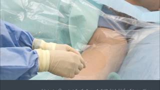 Having a Peripherally Inserted Central Catheter – PICC Arabic [upl. by Alabaster207]