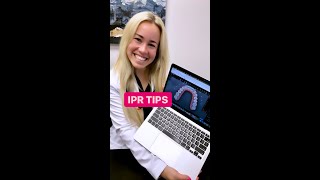 IPR Tips for Invisalign ClinChecks [upl. by Roselia]