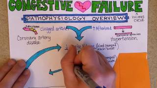 Congestive Heart Failure Pathophysiology [upl. by Doris256]