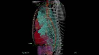 Collimating Thorax Radiographs in Small Animal Veterinary Radiology [upl. by Llevaj602]