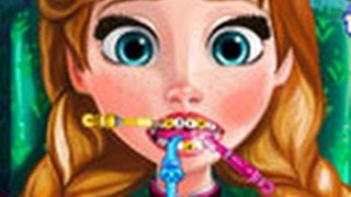 Limpeza Nos Dente Da PRINCESA ANNA JOGO  Cleaning Teeth In The PRINCESS ANNA GAME [upl. by Loginov]