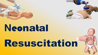 Neonatal Resuscitation  TOACS amp OSCE Station [upl. by Terr53]