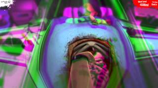 Surgeon Simulator 2013  Kidney Transfer on Drugs [upl. by Boothman396]