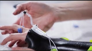 Dorsal wrist orthosis Orfilight Black with Orfitube outrigger  Splinting techniques 810 [upl. by Gennaro]