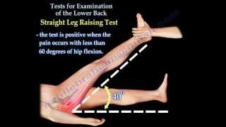 Tests For Examination Of The Lower Back  Everything You Need To Know  Dr Nabil Ebraheim [upl. by Goldin]