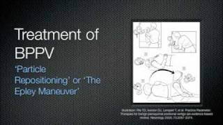 BPPV Education Video 2011wmv [upl. by Ciapha]