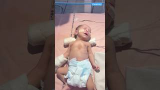 Newborn baby video medical viralvideo [upl. by Lilia]