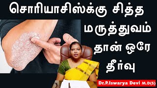 Psoriasis siddha treatment in tamil  DrPIswarya Devi MDSiddha [upl. by Saval92]