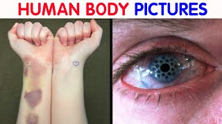 “My Eye Is Gradually Losing Its Color” 50 Interesting Human Body Pics [upl. by Yim]