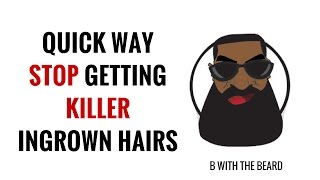 STOP Getting Killer Ingrown Hairs  1 Healthy Tool  MR Scrub [upl. by Leile]