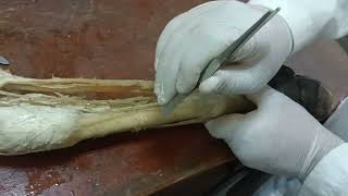 Muscles of forearm extensors and flexors دكتور رمضان ساري [upl. by Gasser]