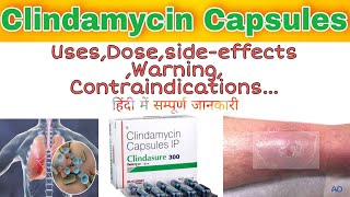 Clindamycin Capsules usesdosagesideeffects  Clindamycin Capsule 300mg  Clindamycin 600mg [upl. by Ellekcir]