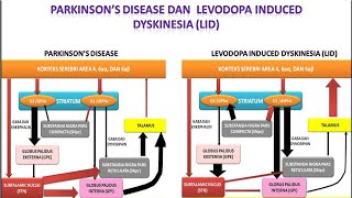 Video 52 Parkinsons Disease dan Levodopa Induced Dyskinesia LID [upl. by Odille]