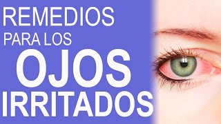 REMEDIOS CASEROS PARA LOS OJOS ROJOS E IRRITADOS  COMO HACER GOTAS PARA LOS OJOS ROJOS [upl. by Ahsele232]