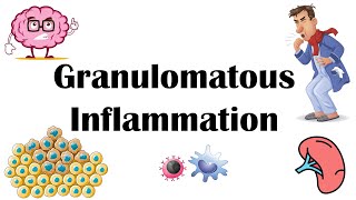 Granulomatous Inflammation  Types Pathophysiology Different Cell Types In Granuloma amp Examples [upl. by Ronal]