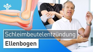 Schleimbeutelentzündung am Ellenbogen Bursitis – Schwellung selbst behandeln oder sofort zum Arzt [upl. by Urina161]