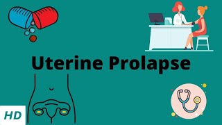 Uterine Prolapse Causes Signs and Symptoms Diagnosis and Treatment [upl. by Courtenay]