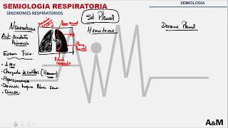 SEMIOLOGIA DEL SÍNDROME PLEURAL [upl. by Jovitta]