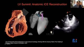 ARRITMIA VENTRICULAR DEL SUMMIT DEL VIESTRATEGIAS ACTUALES PARA LOGRAR EL ÉXITO  Dr Luis Sáenz [upl. by Florence121]