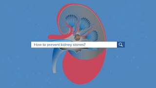 How To Prevent Kidney Stones  Yale Medicine Explains [upl. by Kall]