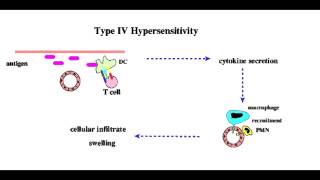 Type 4 Hypersensitivity Type IV [upl. by Oicatsana]