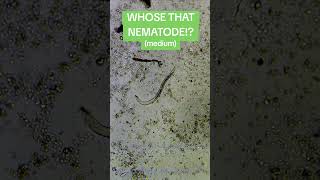 WHOSE THAT NEMATODE DID YOU GET IT TELL ME IN THE COMMENTSnematodes microscope ppn [upl. by Dasi726]