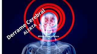 Derrame Cerebral ALERT  The Silent Killer in Your Head [upl. by Lynnea]