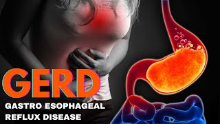 Frequent Sour Burps  quotGERD Symptoms Causes and Treatment Options Explained in Telugu [upl. by Rednal]