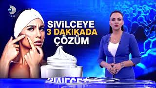 Sivilceye karşı 3 dakikada kesin cözüm [upl. by Feinberg]