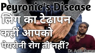 Peyronies Disease  पेयरोनी रोग लिंग का टेढ़ापन कहीं आपको पेयरोनी रोग तो नहींइसका करें 100 इलाज। [upl. by Clemmie]