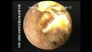 Differences in 3 types of ear conditions [upl. by Ijnek]