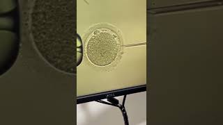 ICSI Intra cytoplasmic sperm injection technique bookplusacademy [upl. by Elladine]