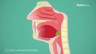 Dysphagie troubles de la déglutition et Fausse route questce que cest [upl. by Kraft]