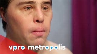 Plastic surgery with down syndrome in Spain  vpro Metropolis [upl. by Abell]